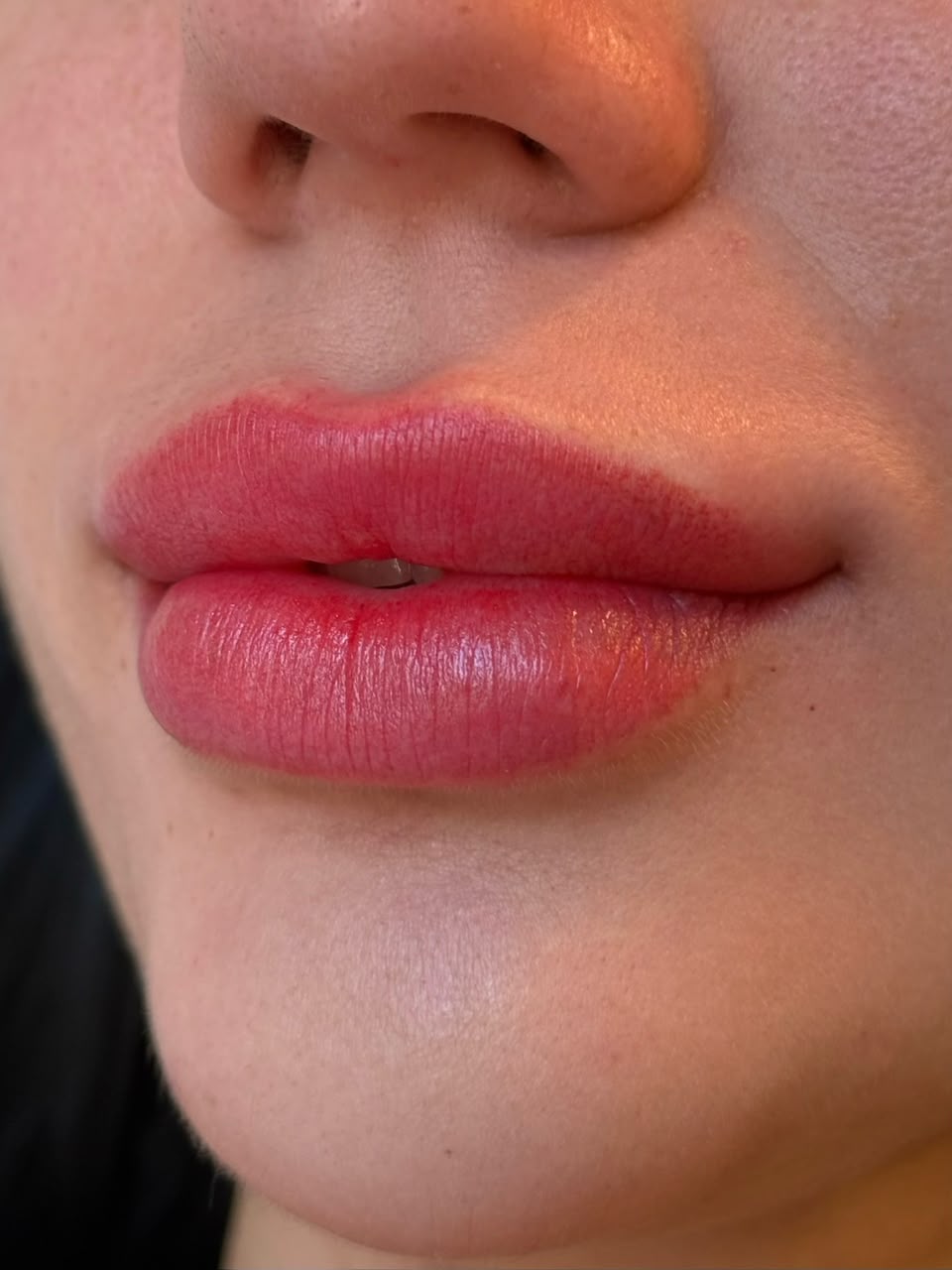 Microlabial